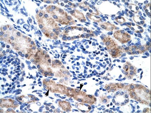 CLIC1 / NCC27 Antibody (aa62-111, Biotin)