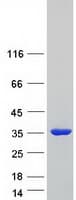 Human TPM3 Protein (Recombinant Myc-DDK (Flag))