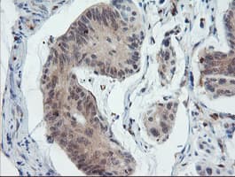 PYCARD / ASC / TMS1 Antibody (clone OTI2A7)