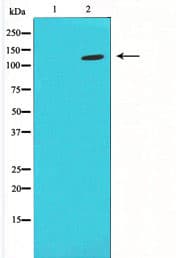 Polyclonal Rabbit anti-Human PLCB2 Antibody (IF, WB)