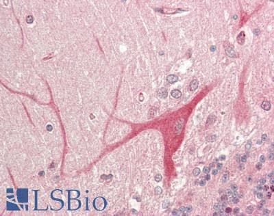 PINK1 Antibody (aa350-500, DY650)