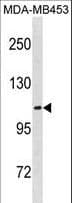 ENPP3 / CD203c Antibody (aa814-843)