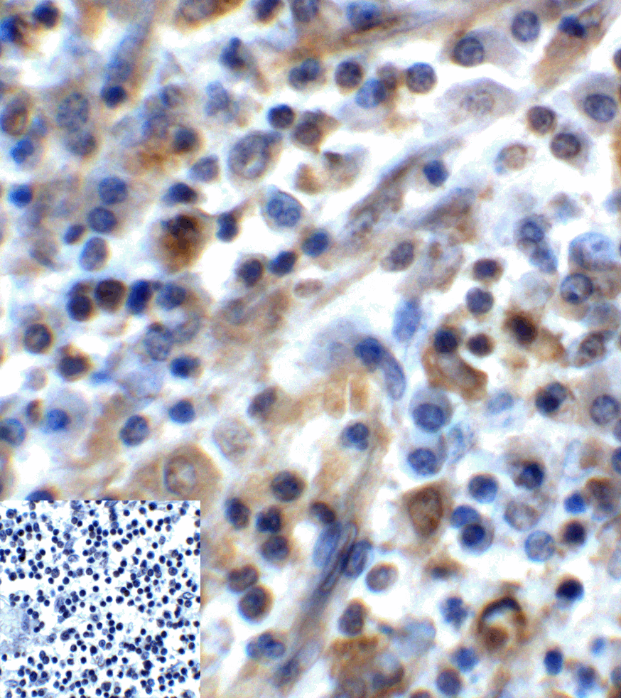 TIGIT Antibody (clone 7.00E+05)