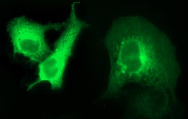 ANKRD49 Antibody (clone OTI3E4)