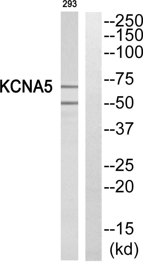 Polyclonal Rabbit anti-Human KCNA5 / Kv1.5 Antibody (WB)