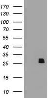 BCL10 / BCL-10 Antibody (clone OTI1B3)