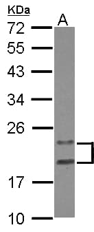 Polyclonal Rabbit anti-Human PYCARD / ASC / TMS1 Antibody (WB)