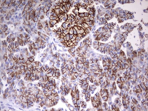 Monoclonal Mouse anti-Human EPCAM Antibody (clone UMAB131, IHC, WB)