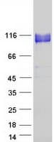 Human ITGB5 / Integrin Beta 5 Protein (Recombinant Myc-DDK (Flag))