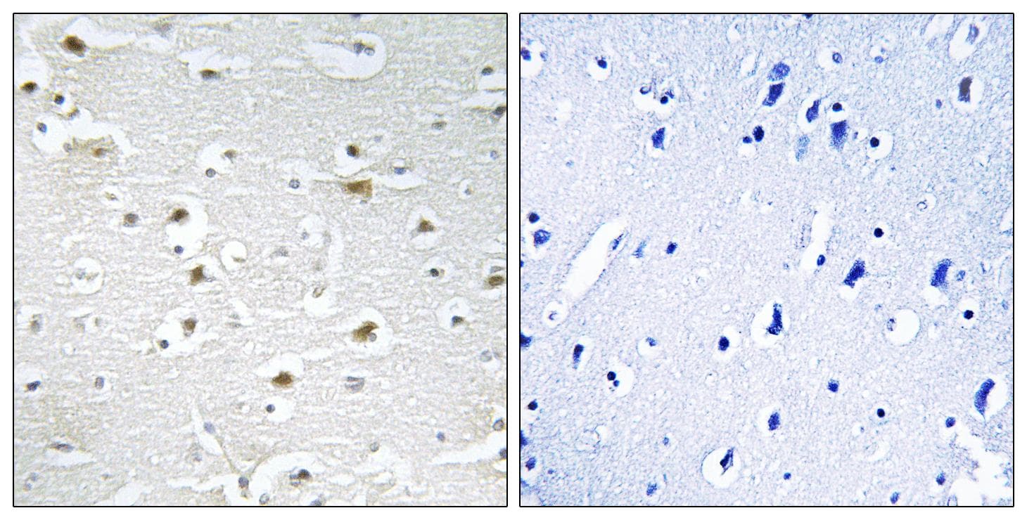 DDX3Y Antibody