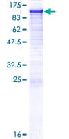 Human PDXDC1 Protein (Recombinant GST)