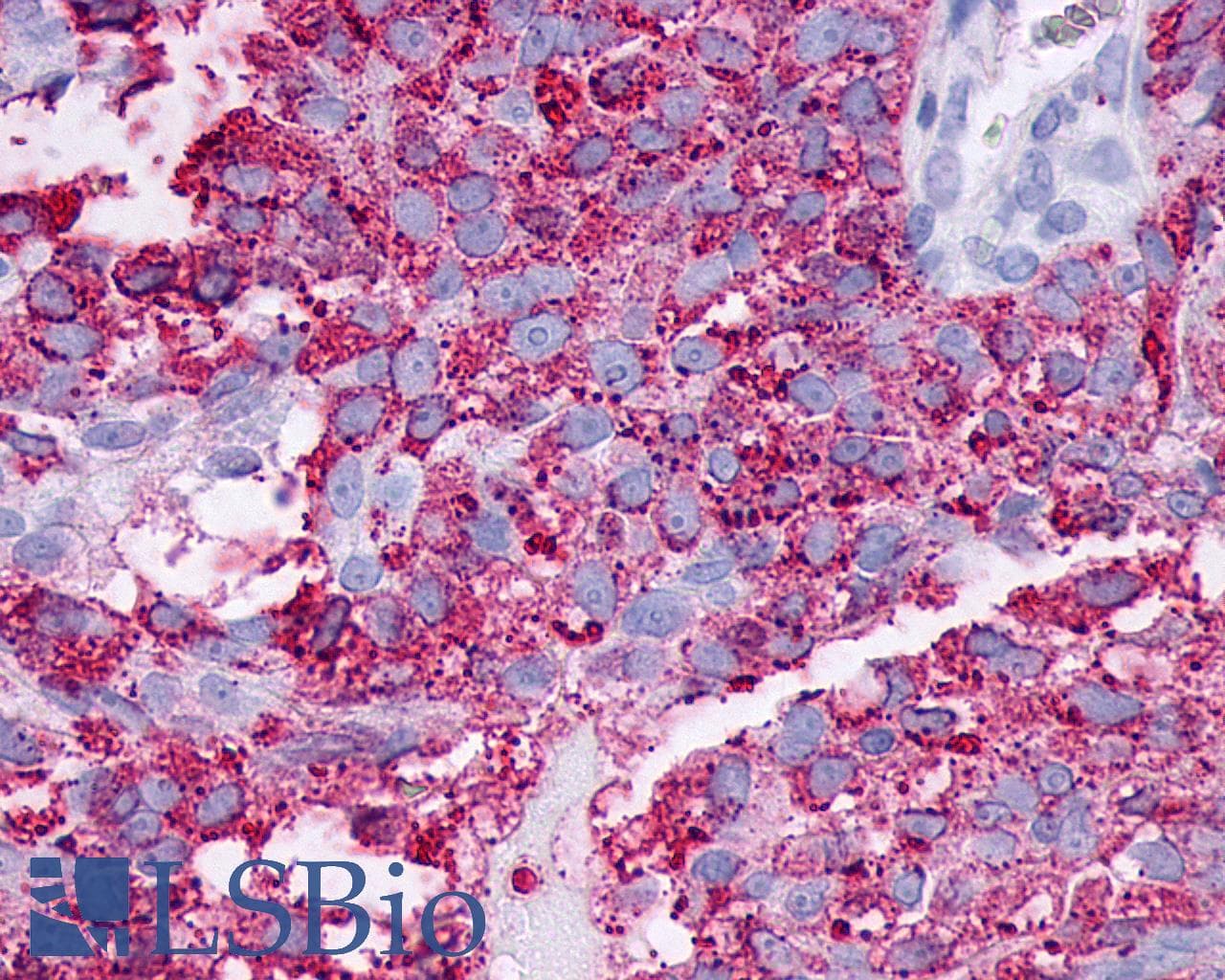 PathPlus™ Polyclonal Rabbit anti-Human F2RL3 / PAR4 Antibody (Extracellular Domain, IHC)