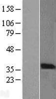 PIM2 / Pim-2 Protein (Over-Expression Lysate Myc-DDK (Flag))