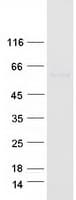 Human E2F1 Protein (Recombinant Myc-DDK (Flag))