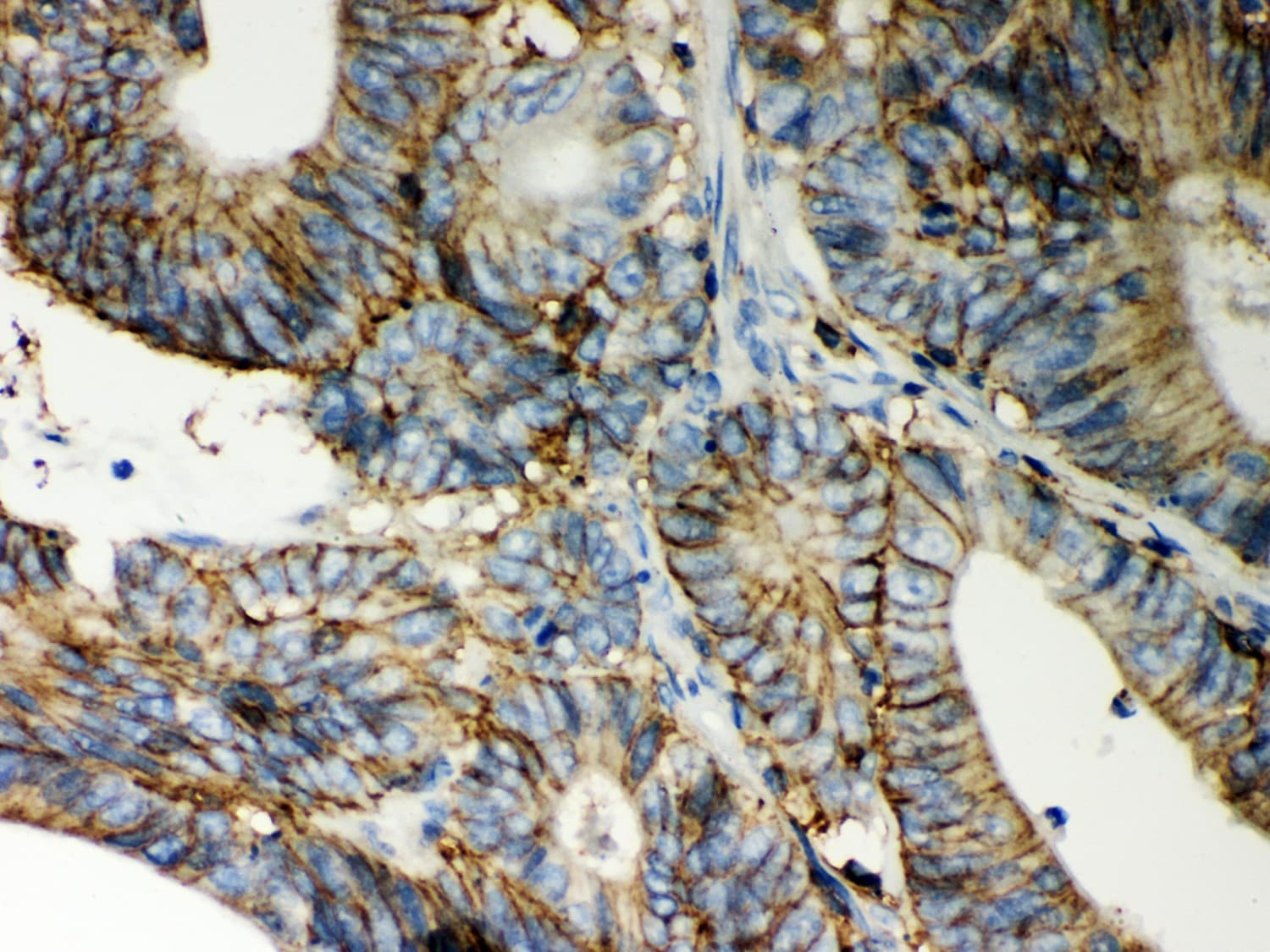 Polyclonal Rabbit anti-Human CD44 Antibody (aa29-56, IHC, WB)