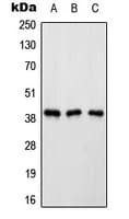 ATP6AP2 / Renin Receptor Antibody (Internal)