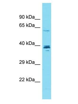 Polyclonal Rabbit anti-Human CCDC149 Antibody (aa370-419, WB)