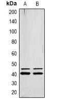 Polyclonal Rabbit anti-Human ERK1 + ERK2 Antibody (phospho-Tyr222/205, WB)