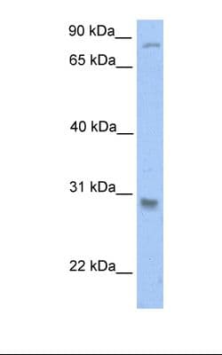 GSTT1 Antibody (C-Terminus)