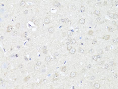 CASP3 / Caspase 3 Antibody