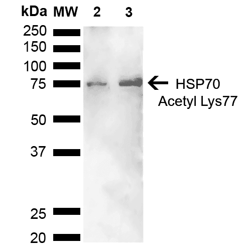 HSP70 / Heat Shock Protein 70 Antibody