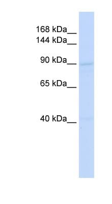 RAD54B Antibody (C-Terminus)