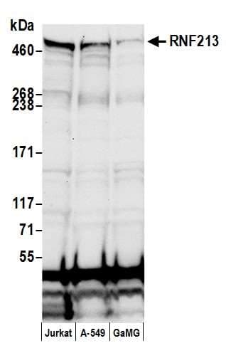 RNF213 Antibody (aa4300-4350)