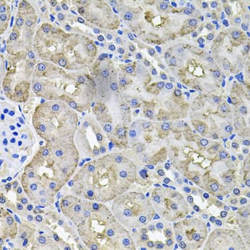 ACO1 / Aconitase Antibody