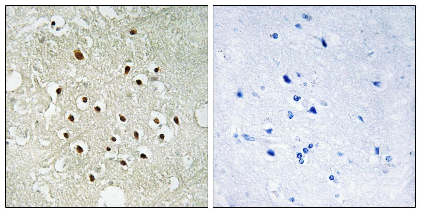 Polyclonal Rabbit anti-Human RPS19BP1 Antibody (IHC)