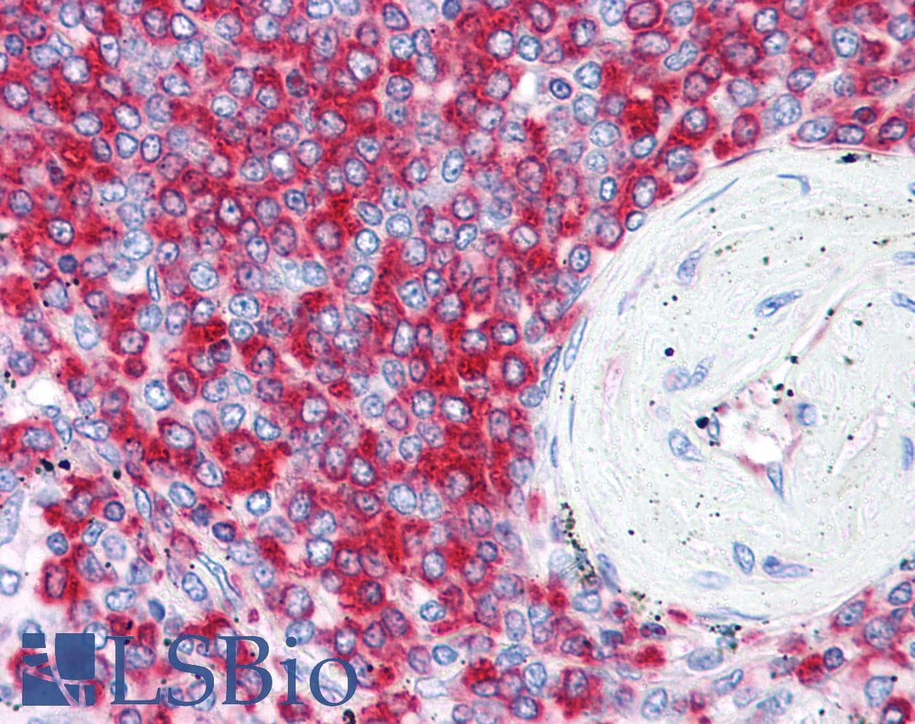 IHC-plus™ RPS2 / Ribosomal Protein S2 Antibody (clone 3G6)