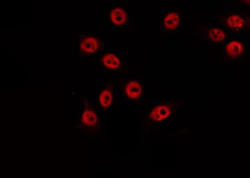 DUSP22 / JSP 1 Antibody