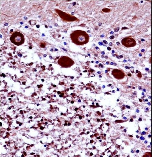 Polyclonal Rabbit anti-Human NCS1 / Neuronal Calcium Sensor Antibody (aa1-30, IHC, WB)