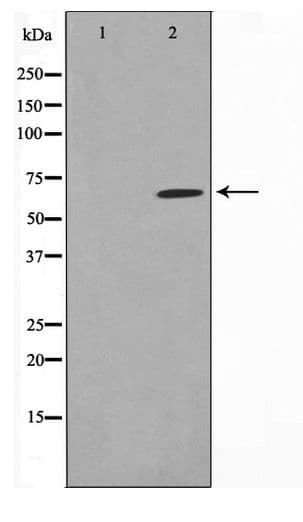 Polyclonal Rabbit anti-Human PIAS1 Antibody (IHC, WB)