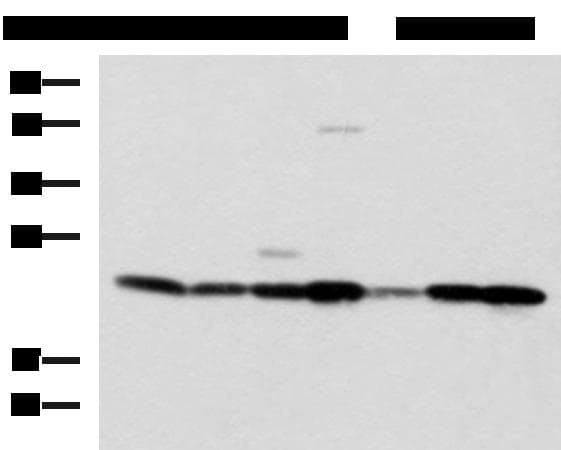 Polyclonal Rabbit anti-Human ATP5O Antibody (IHC, WB)