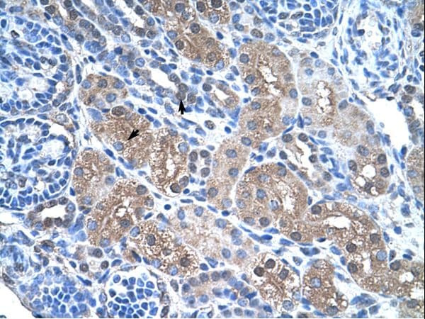 FBP1 Antibody (aa114-163, Biotin)