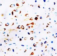 GRIN2A / NMDAR2A / NR2A Antibody (aa1411-1427, Magnetic beads)