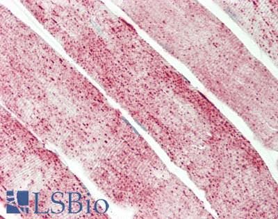 IHC-plus™ Monoclonal Mouse anti-Human GBAS Antibody (clone 1B8, IHC, IF, WB)