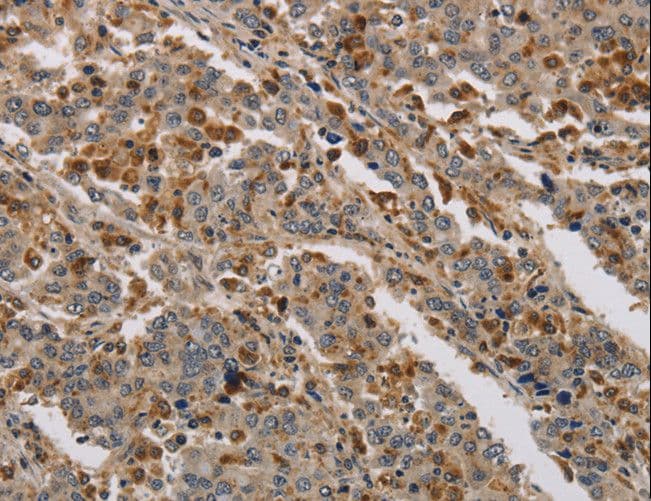 KDM4A / JHDM3A / JMJD2A Antibody