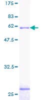 Human SMN2 Protein (Recombinant GST)