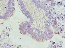TUBA3E / Tubulin Alpha 3E Antibody