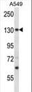 PSMD1 Antibody (aa104-132)