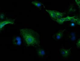 TUBB4 / Tubulin Beta 4 Antibody (clone OTI8E3)