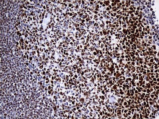 RB1 / Retinoblastoma / RB Antibody (aa309-590, clone OTI13A6)