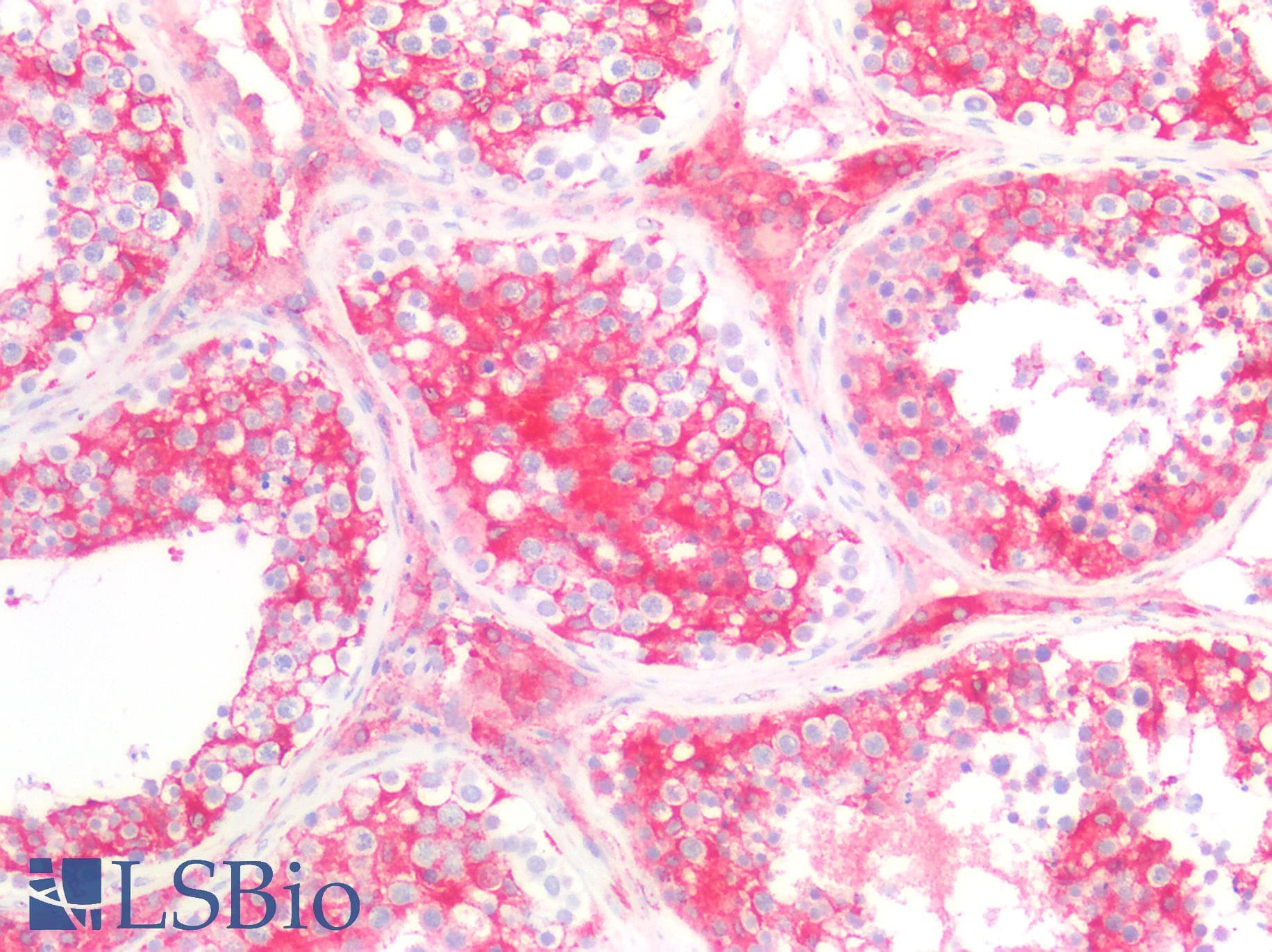 PathPlus™ MVP / VAULT1 Antibody (aa158-380)