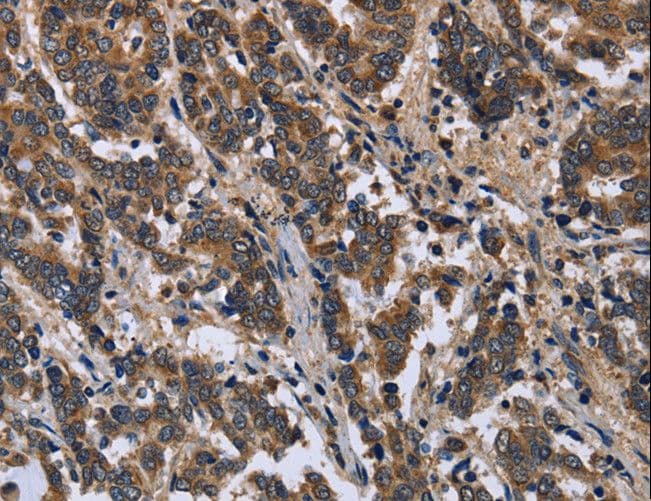 Polyclonal Rabbit anti-Human FRK Antibody (IHC, WB)