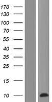 PRCD Protein (Over-Expression Lysate Myc-DDK (Flag))