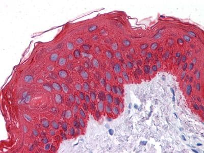 Pan Cytokeratin Antibody (clone 7H8C4)