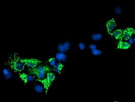 SIRT5 / Sirtuin 5 Antibody (clone OTI2F1)