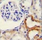 Polyclonal Rabbit anti-Human HYAL2 Antibody (aa385-412, IHC, WB)