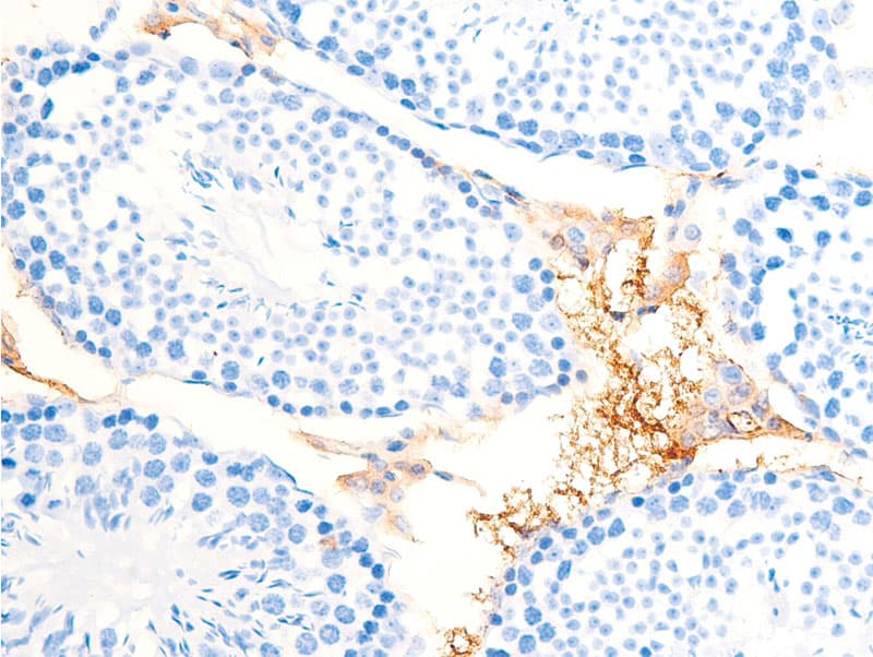 CHEK1 / CHK1 Antibody (phospho-Ser286)
